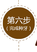 德倫數字化種植牙技術流程